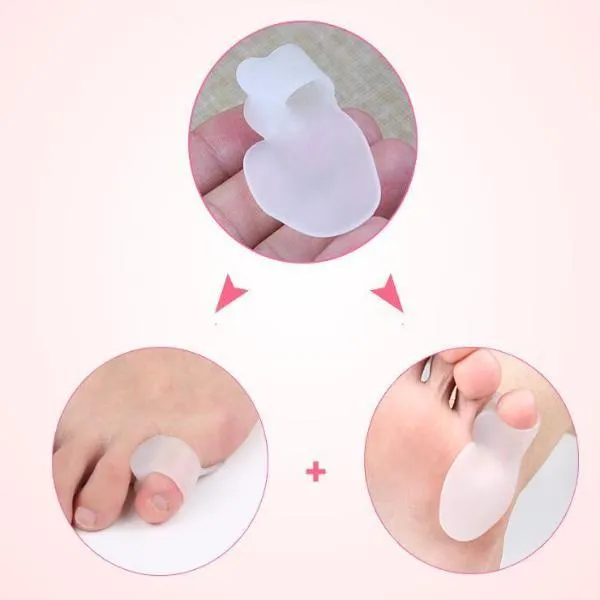 Bunionette Corrector