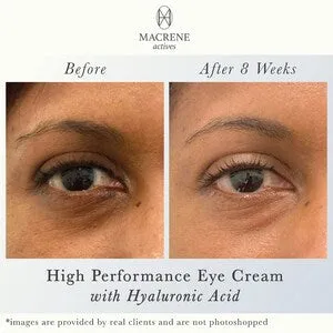 MACRENE actives High Performance Eye Cream